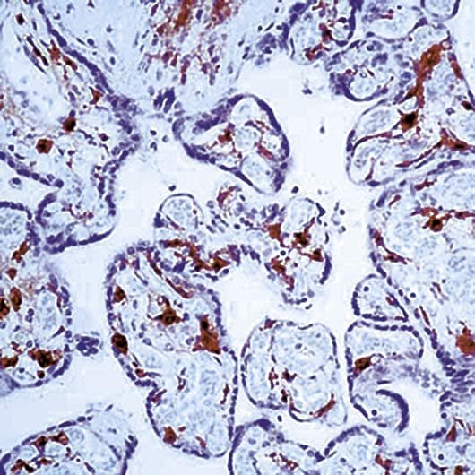 F13A1 / Factor XIIIa Antibody (clone AC-1A1)