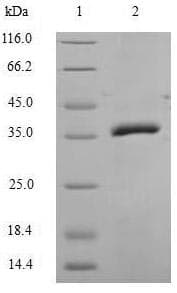 Mouse Properdin / CFP Protein (Recombinant 6His, N-terminus)