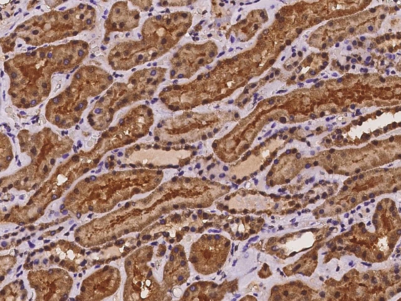CDCA8 / Borealin Antibody