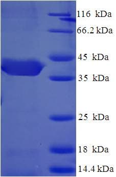 Human CUEDC2 Protein (Recombinant His-SUMO)