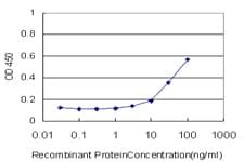 F8 / FVIII / Factor VIII Antibody (clone 1E8)