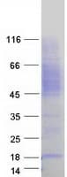 Human ICAM2 / CD102 Protein (Recombinant Myc-DDK (Flag))