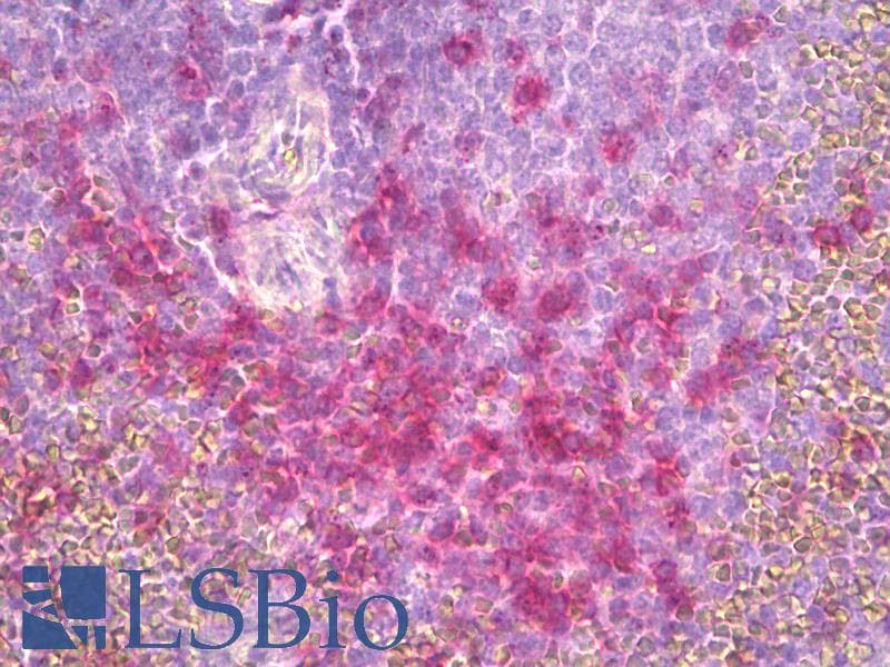 PathPlus™ Monoclonal Mouse CD45RO Antibody (clone UCHL-1, IHC, WB)