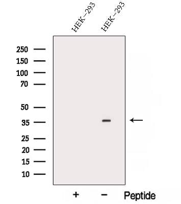 ARMC10 Antibody