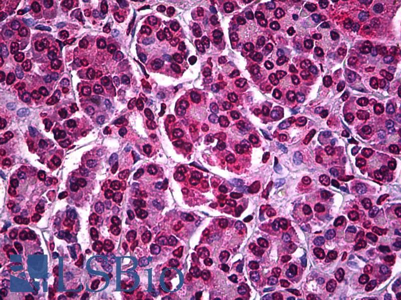 IHC-plus™ ATF5 Antibody (clone 4G5)