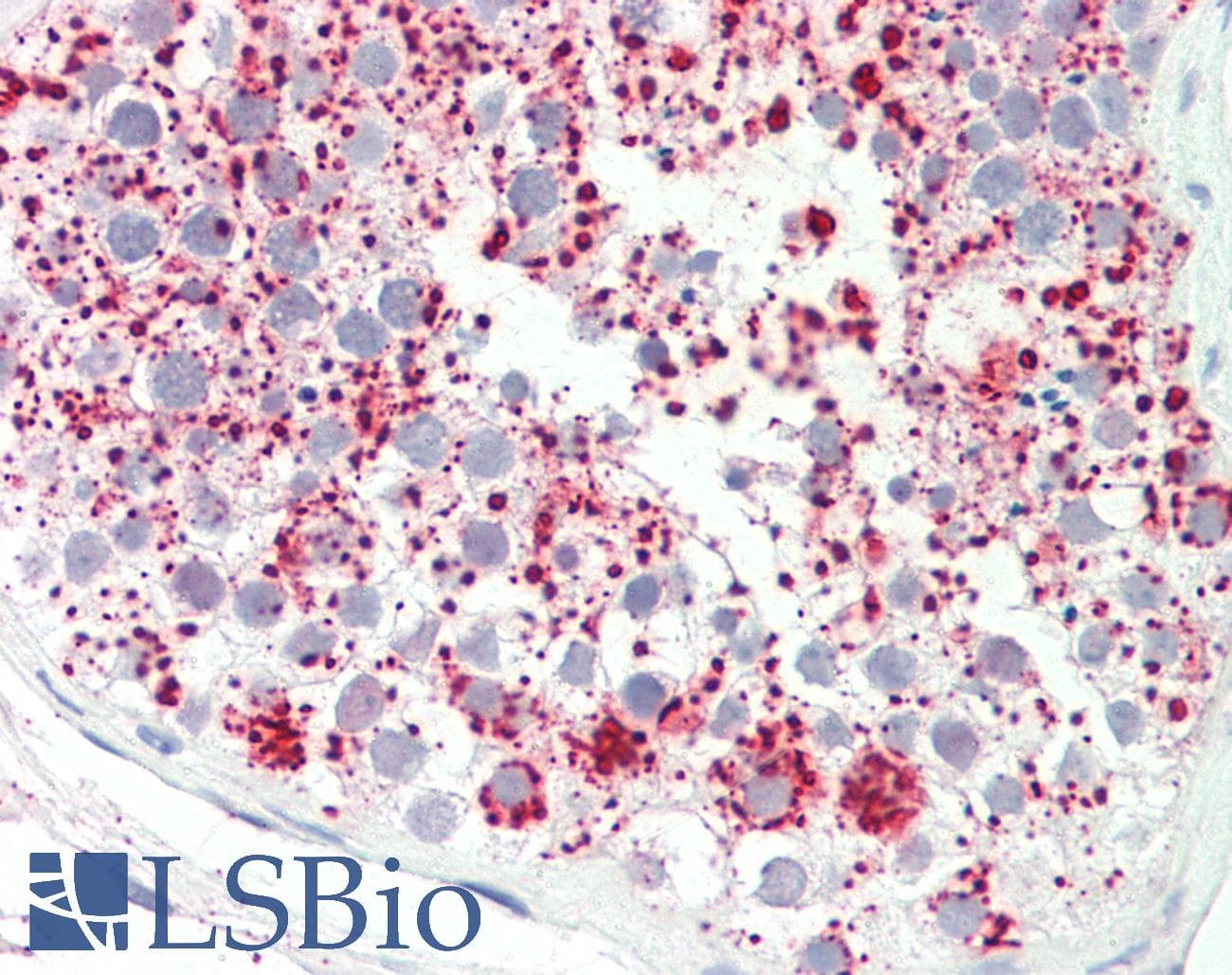 IHC-plus™ EPHA10 / EPH Receptor A10 Antibody (clone 2E8)