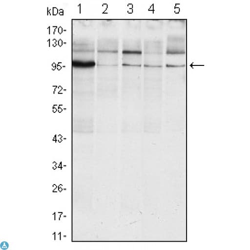 Monoclonal Mouse anti-Human ERN1 / IRE1 Antibody (IHC, WB)