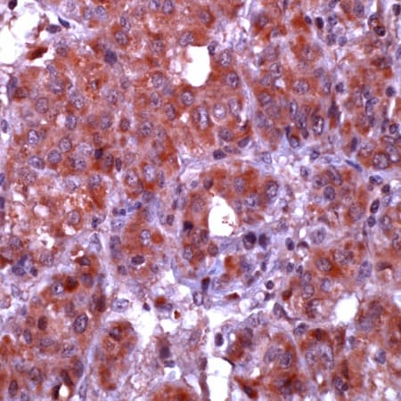 CASP10 / Caspase 10 Antibody (C-Terminus)