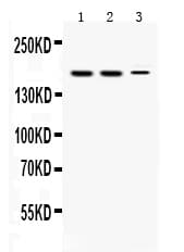 KDM5B / JARID1B Antibody