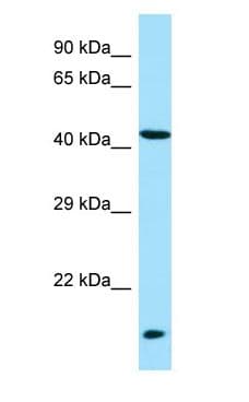 LIPM / LIPL3 Antibody (aa59-108)