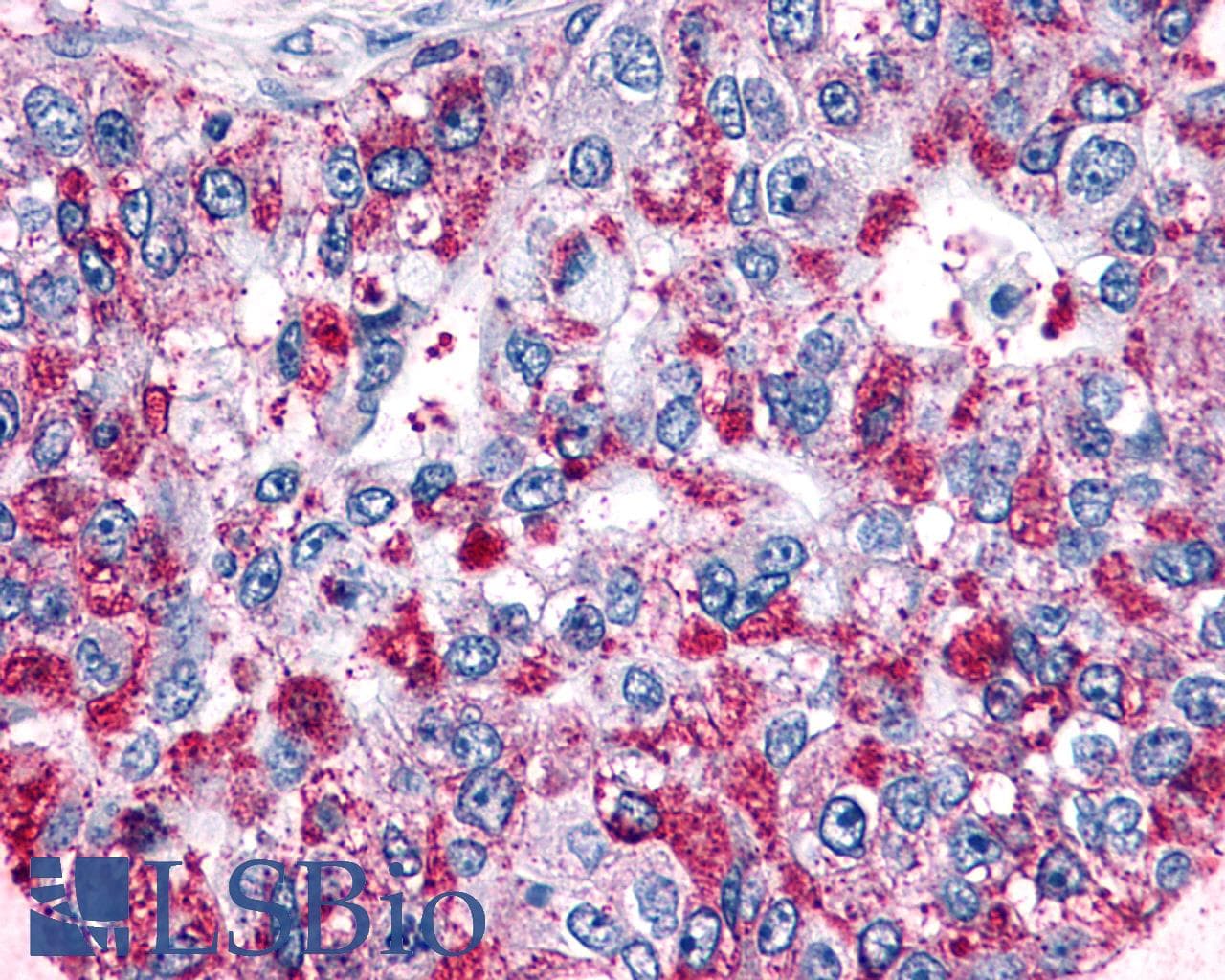 PathPlus™ GPR4 Antibody (C-Terminus)