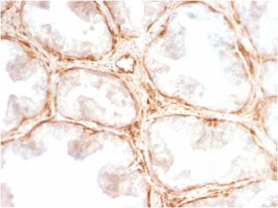 LGALS1 / Galectin 1 Antibody (aa12-108, clone GAL1/2499R, Azide-free, Carrier-free)