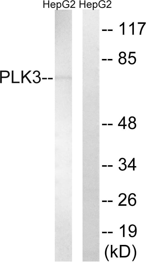 Polyclonal Rabbit anti-Human PLK3 Antibody (aa231-280, WB)