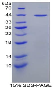 Mouse PRG2 / Proteoglycan 2 Protein (Recombinant His-GST)