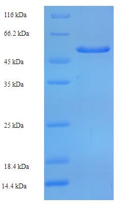 Human SIRPA / CD172a Protein (Recombinant His-SUMO)