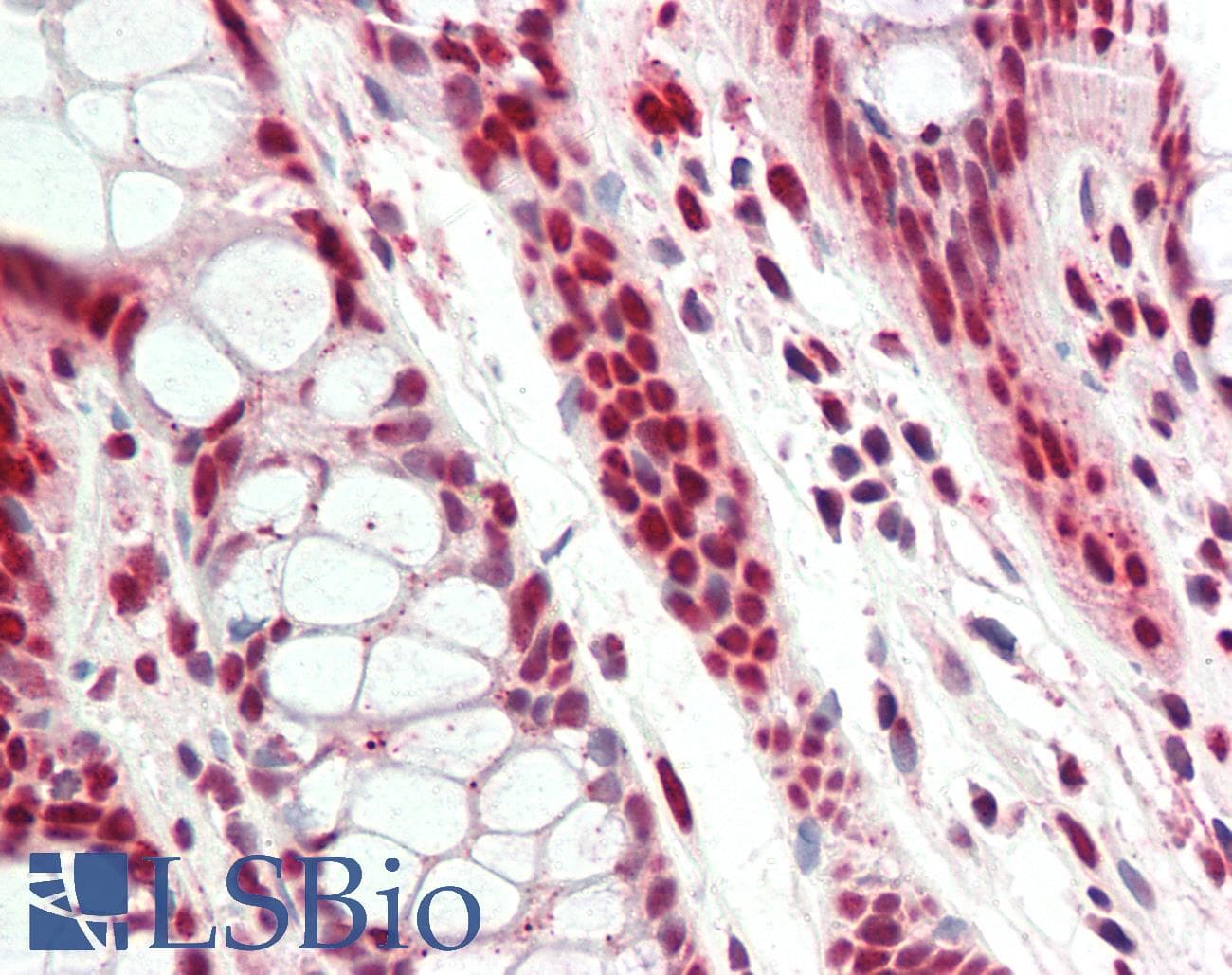 PHAP1 / ANP32A Antibody (aa121-170)