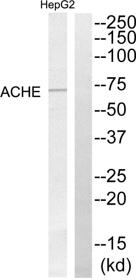ACHE / Acetylcholinesterase Antibody