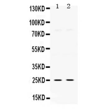 Polyclonal Rabbit anti-Human TK1 / TK / Thymidine Kinase Antibody (aa2-234, WB)