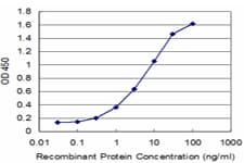 MDH / MDH2 Antibody (clone 2B7)