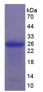 Human ORM2 / Orosomucoid 2 Protein (Recombinant His, N-Terminal)