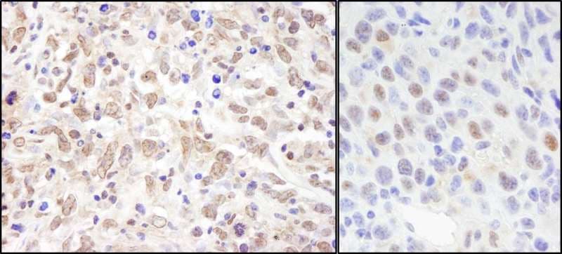 SIN3A Antibody (aa1-50)