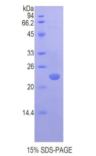 Mouse CBX3 / HP1 Gamma Protein (Recombinant His)