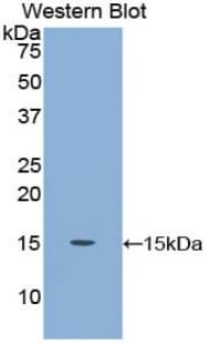 CEA / Carcinoembryonic Antigen Antibody (aa566-698)