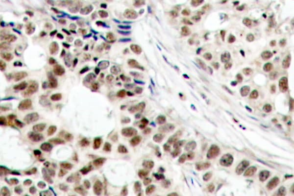 BRCA1 Antibody (phospho-Ser1423)