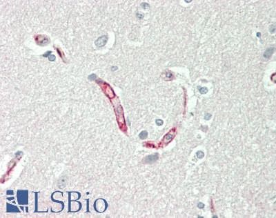 IHC-plus™ Basigin / Emmprin / CD147 Antibody (clone 5D8)