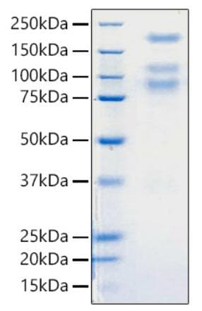 Coronavirus SARS-CoV-2 Spike Glycoprotein (Recombinant 6His, C-terminus)