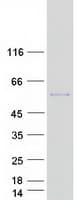 Human PICK1 Protein (Recombinant Myc-DDK (Flag))