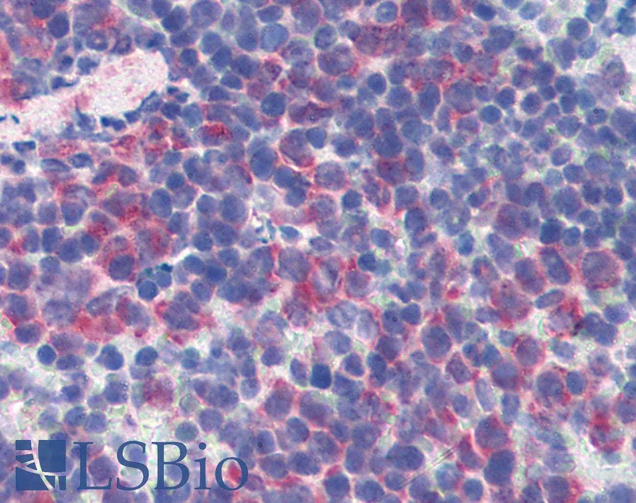 IHC-plus™ Monoclonal Hamster-Armenian anti-Mouse CD69 Antibody (clone H1.2F3, FITC, IHC)