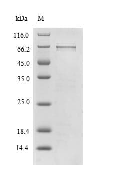 Human TXNIP Protein (Recombinant 6His-SUMO, N-terminus)