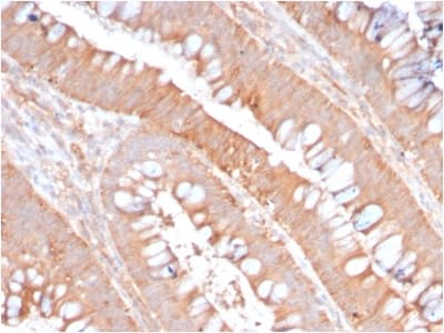 CD59 Antibody (clone MACIF/2867R, Azide-free, Carrier-free)