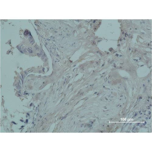 PR / Progesterone Receptor Antibody (clone Z15)