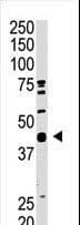 Polyclonal Rabbit anti-Human SAE1 Antibody (aa300-329, IHC, WB)