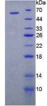 Pig FLT1 / VEGFR1 Protein (Recombinant His-GST, N-terminus)