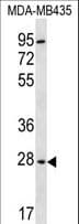Polyclonal Rabbit anti-Human BPGM Antibody (aa230-259, WB)