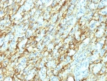 FN1 / Fibronectin Antibody (clone 568)