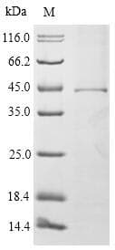 Mouse FcERI / Fc Epsilon RI Protein (Recombinant 10His-SUMO, N-terminus)