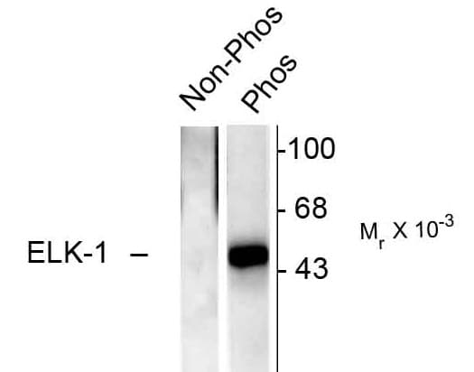 ELK1 Antibody (phospho-Ser383)