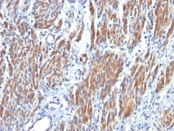 SMMHC / MYH11 Antibody (clone SMMS-1, Ready-to-Use)
