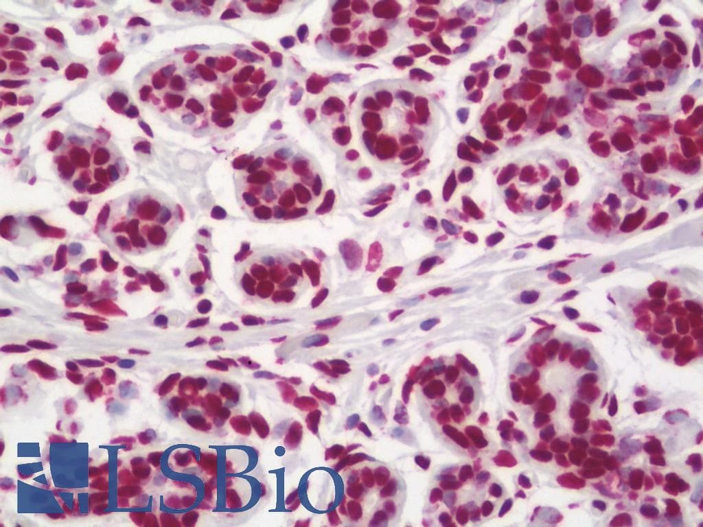 IHC-plus™ p16INK4a / CDKN2A Antibody (clone 5A8A4,3G8D12)