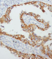 Polyclonal Rabbit anti-Human TNF Alpha Antibody (IHC, WB)