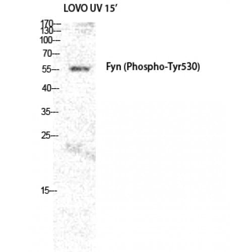 SYN / FYN Antibody (460-540 aa)