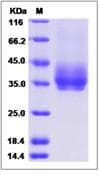 Rat PD-L2 / PDCD1LG2 / CD273 Protein (Recombinant His,C-terminus)