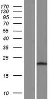 DPH6 / ATPBD4 Protein (Over-Expression Lysate Myc-DDK (Flag))