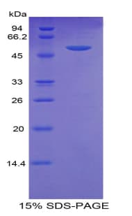 Pig TFF3 / Trefoil Factor 3 Protein (Recombinant His-MBP)