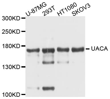 Polyclonal Rabbit anti-Human UACA Antibody (IF, WB)