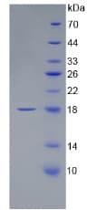 Mouse APP / Beta Amyloid Precursor Protein (Recombinant His, N-Terminal)
